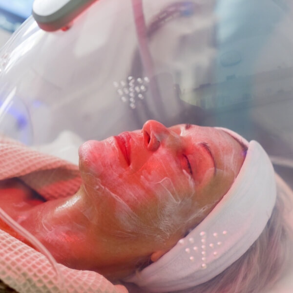 FACIAL OXIGEN
