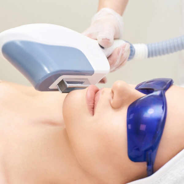 DEPILACIÓN IPL FACIAL