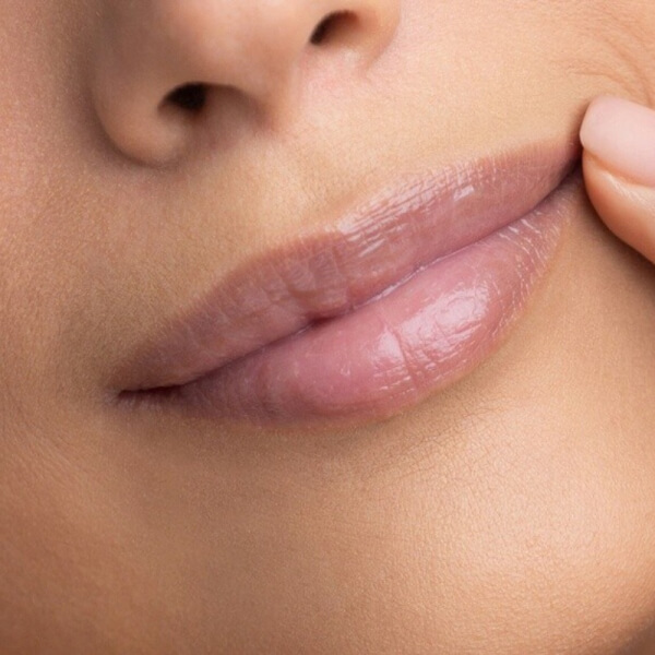 LABIOS