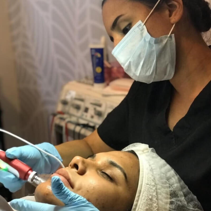 SESIÓN DERMAPEN