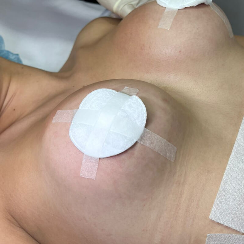 MASAJES POST-OPERATORIO