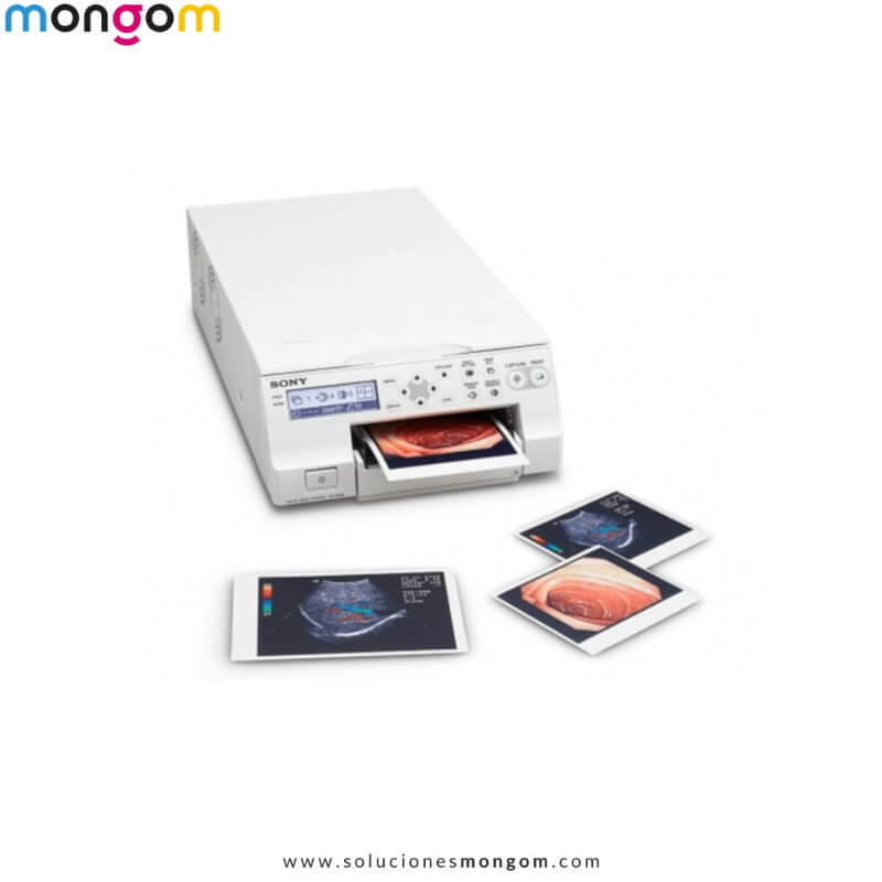 Impresora Médica Sony UP-27MD A6 | Grado Médico para Endoscopia, Ultrasonido y Cardiología | Alta Resolución 423 dpi | Soluciones Mongom