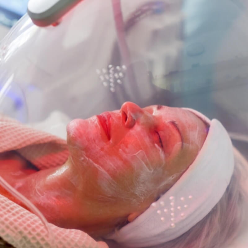 FACIAL OXIGEN 3X2