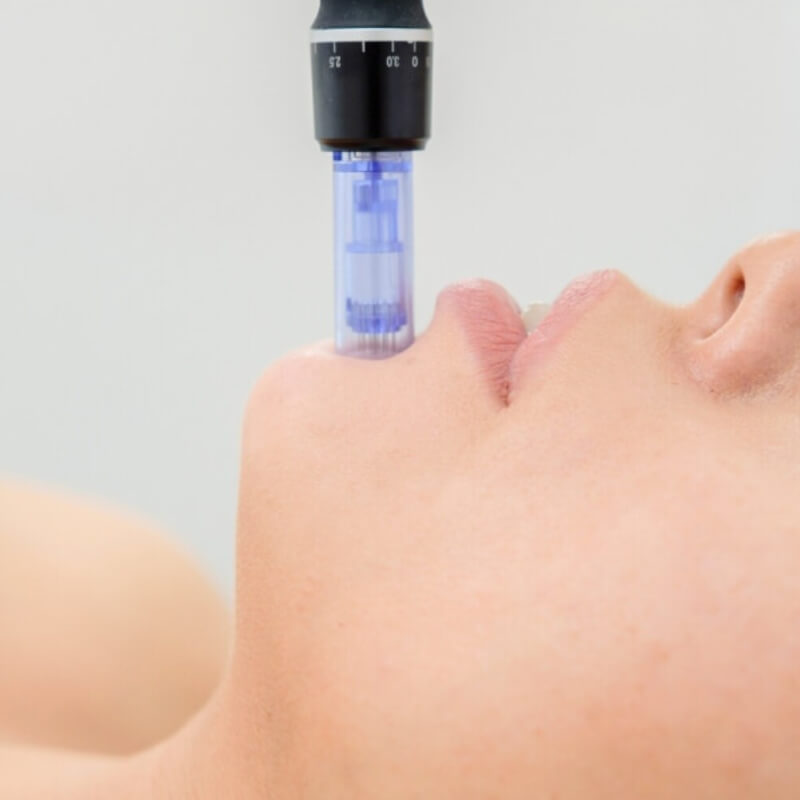 SESION GLOWSKIN EXOSOMAS