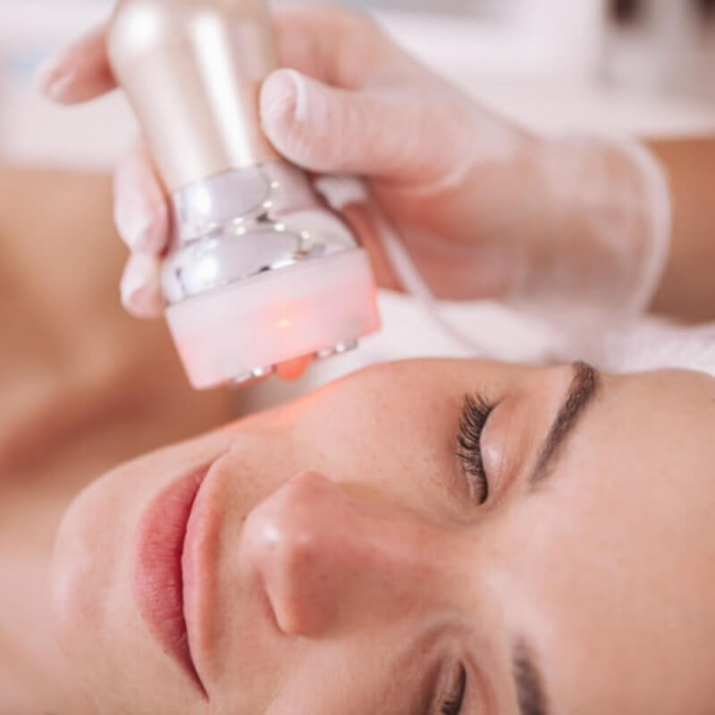 PLASMA GLOW (sin agujas)