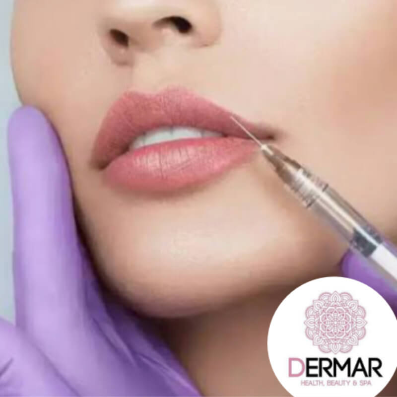 Relleno y perfilado de labios