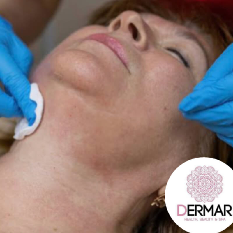 Perfilamiento de óvalo facial